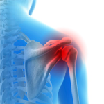 Baseball and Shoulder Injuries