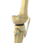 Pediatric Tibial Tubercle Fractures