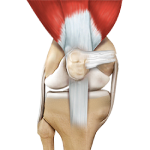 Quadriceps Tendon Repair