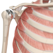 Shoulder Joint Replacement