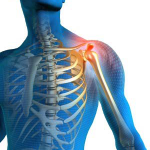 Shoulder Pain