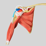 Subacromial Decompression